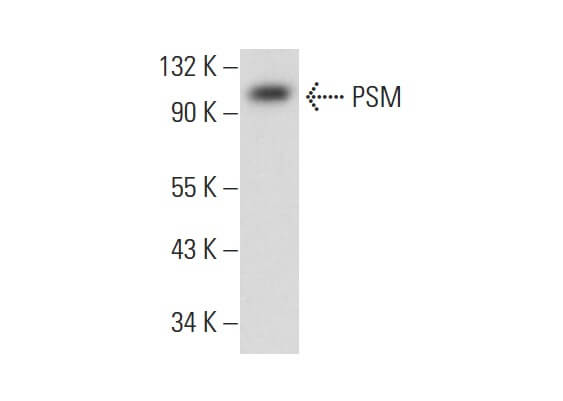 Anti-PSM Antibody (F-2) | SCBT - Santa Cruz Biotechnology