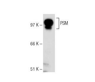 PSM Antibody (Y-PSMA2) - Western Blotting - Image 18062 
