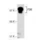 PSM Antibody (Y-PSMA2) - Western Blotting - Image 18062 