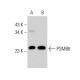 PSMB6 Antibody (B-6) - Western Blotting - Image 377904