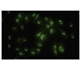 PSMC6 Antibody (34-Q) - Immunofluorescence - Image 35579 