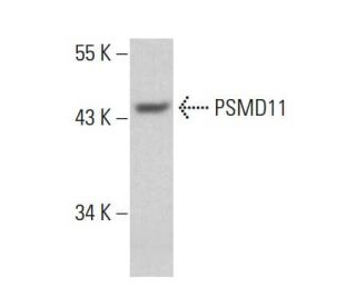 PSMD11 Antibody (AT1F4) - Western Blotting - Image 384541 