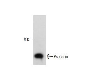 Psoriasin Antibody (H-6) - Western Blotting - Image 281202 
