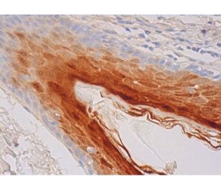 Psoriasin Antibody (H-8) - Immunohistochemistry - Image 293466 
