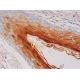 Psoriasin Antibody (H-8) - Immunohistochemistry - Image 293466 