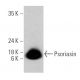Psoriasin Antibody (H-8) - Western Blotting - Image 359573