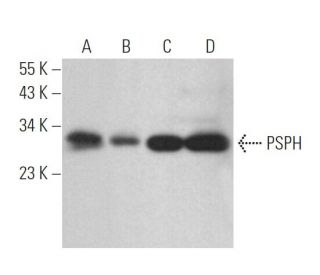 PSPH Antibody (H-10) - Western Blotting - Image 365197 