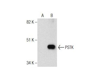 PSTK Antibody (B-5) - Western Blotting - Image 160453 