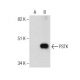 PSTK Antibody (B-5) - Western Blotting - Image 160453 