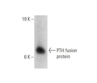 PTH Antibody (D1.5) - Western Blotting - Image 144639