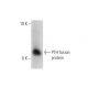 PTH Antibody (D1.5) - Western Blotting - Image 144639