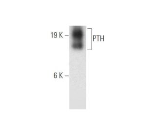 western blotting image from recommended PTH (H-7) monoclonal antibody replacement. Image 314190