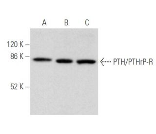 PTH/PTHrP-R Antibody (3D1.1) - Western Blotting - Image 355477