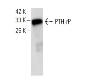 western blotting image from recommended PTH-rP (1D1) monoclonal antibody replacement. Image 47815