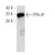 This polyclonal antibody has been discontinued. See our recommended <a href="pth-rp-antibody-1d1">PTH-rP (1D1)</a> monoclonal antibody (sample data shown). western blotting image from recommended PTH-rP (1D1) monoclonal antibody replacement. Image 47815