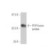 PTIP Antibody (4C11) - Western Blotting - Image 349530