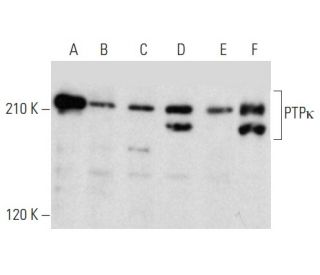 PTPκ Antibody (H-3) - Western Blotting - Image 357368Each CRISPR/Cas9 Knockout (KO) Plasmid product consists of a pool of 3 plasmids designed to ensure identification and cleavage of a specific gene for maximum knockout efficiency. Each plasmid encodes a unique 20 nt sequence derived from the GeCKO (v2) library.