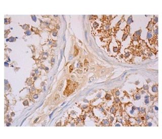 PTPN13LY Antibody (H-9) - Immunohistochemistry - Image 350221