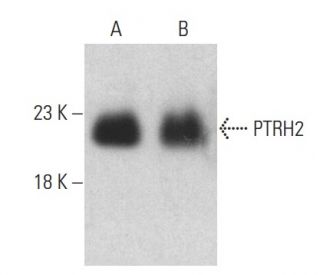 PTRH2 Antibody (E-7) - Western Blotting - Image 401024
