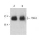 PTRH2 Antibody (E-7) - Western Blotting - Image 401024