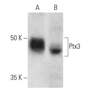 アナキャン　ANCAN メタヘキテ ptx3-antibody-c-10-western-