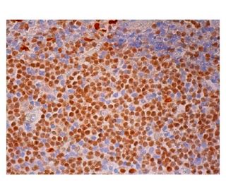 PU.1 Antibody (C-3) - Immunohistochemistry - Image 301858