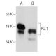 PU.1/Spi1 Antibody (C-3) | SCBT - Santa Cruz Biotechnology