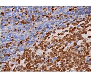 PU.1/Spi1 Antibody (Spi-1) - Immunohistochemistry - Image 369123 