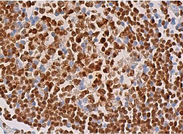 Anti-PU.1/Spi1 Antibody (B-9) | SCBT - Santa Cruz Biotechnology