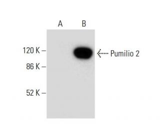 Pumilio 2 Antibody (A-10) - Western Blotting - Image 306594 