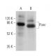Punc Antibody (F-3) - Western Blotting - Image 369951 