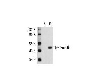 Punctin/ADAMTSL1 Antibody (PU29Z) - Western Blotting - Image 31742