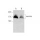 survivin (M-16): sc-8809. Western blot analysis of survivin expression in untreated (A) and Cdk2 Inhibitor IV, NU6140 (sc-