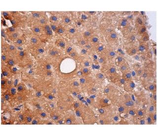 immunohistochemistry image from recommended PXR (G-11) monoclonal antibody replacement. Image 282269