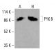 PYGB Antibody (B-5): sc-518267. Western blot analysis of PYGB expression in HeLa (A) and HCT-116 (B) whole cell lysates. Detection reagent used: m-IgG<sub>1</sub> BP-HRP: sc-525408. PYGB Antibody (B-5) - Western Blotting - Image 416508