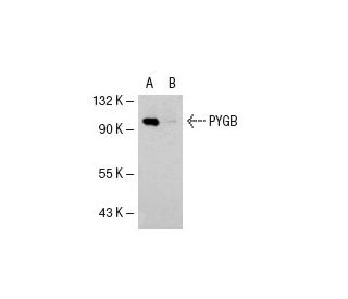 PYGB/M Antibody (3G1) - Western Blotting - Image 19499 