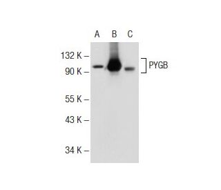 western blotting image from recommended PYGB/M (10H5) monoclonal antibody replacement. Image 72812