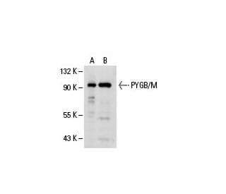 PYGB/M Antibody (3G1) - Western Blotting - Image 19503 