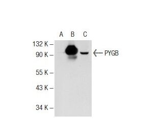 PYGB/M Antibody (6F1) - Western Blotting - Image 72824 