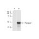 Pygopus 1 Antibody (3E1) - Western Blotting - Image 352186 