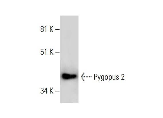 Pygopus 2 Antibody (B-12) | SCBT - Santa Cruz Biotechnology