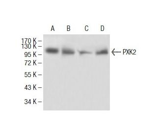 PYK2 Antibody (5E2D5) - Western Blotting - Image 137480 