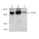 PYK2 Antibody (5E2D5) - Western Blotting - Image 353745 