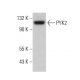 PYK2 Antibody (5E2D5) - Western Blotting - Image 380534