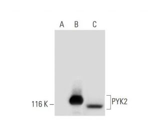 western blotting image from recommended PYK2 (E-3) monoclonal antibody replacement. Image 292949