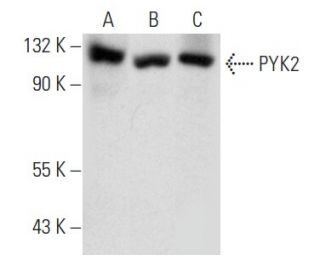 PYK2 Antibody (F-6) - Western Blotting - Image 354317 