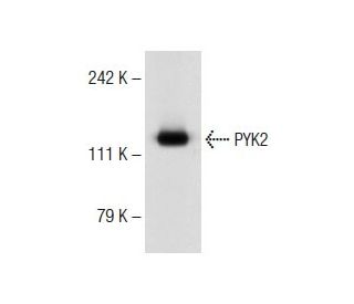 PYK2 Antibody (F-6) - Western Blotting - Image 143820Each CRISPR/Cas9 Knockout (KO) Plasmid product consists of a pool of 3 plasmids designed to ensure identification and cleavage of a specific gene for maximum knockout efficiency. Each plasmid encodes a unique 20 nt sequence derived from the GeCKO (v2) library.
