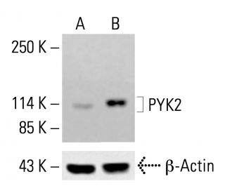 PYK2 Antibody (5E2D5) - Western Blotting - Image 413394