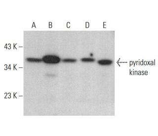 pyridoxal kinase Antibody (E-2) - Western Blotting - Image 376309 