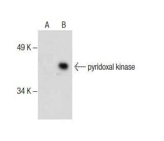pyridoxal kinase Antibody (F-12) - Western Blotting - Image 286017
